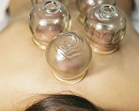 Wind Cupping Therapy (20 mins)